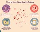 Is Staph Infection Contagious?