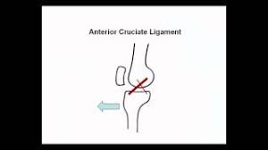 Check spelling or type a new query. Ligament Injuries