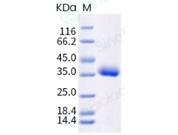 In this video, we take a look at the spike protein mutations from the newly emerged variants in the united states. Recombinant Sars Cov 2 Coronavirus Spike Protein Hek293 Cells His Tag 40592 V08h88 Sino Biological