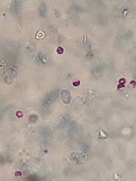 It is capable of causing disease both in immunocompetent and immunocompromised hosts. Cryptosporidium Parvum