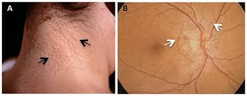 Image result for Pseudoeriosema