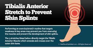 Exercises To Prevent Shin Splints Shin Splints Treatment Shin Splints Shin Splint Exercises