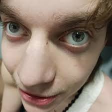 Image result for tbn:ANd9GcSKQ6WZNNgGQRYszRgFbxpr9QGU37z-EFx8LzTd2pp2XVncdrMO4AeJuA