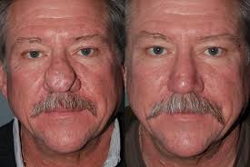 +65 6266 0228 / +65 6266 0268 sms: Gateway Aesthetic Institute And Laser Center 440 W 200 S Ste 250 Salt Lake City Ut 84101