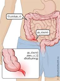 க டல வ ல அழற ச