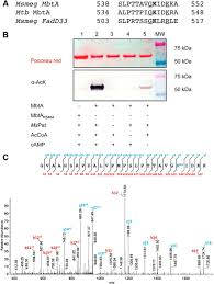 Peki, 49 inç kaç santimdir? Post Translational Acetylation Of Mbta Modulates Mycobacterial Siderophore Biosynthesis Journal Of Biological Chemistry
