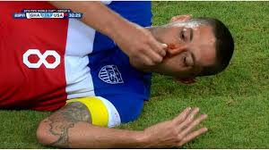 Nosebleeds can be annoying and sometimes scary, especially if you have a bleeding disorder. Clint Dempsey Got Kicked In The Face Possible Broken Nose Sporting News
