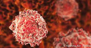 Deze witte bloedcellen rijpen bovendien niet goed uit. Leukamie Symptome Formen Behandlung Netdoktor