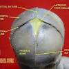 So, the human skull consists of 23 bones. 1