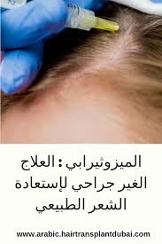 الميزوثيرابي العلاج الغير جراحي لإستعادة الشعر الطبيعي زراعة الشعر Hair Transplant Hair Engagement