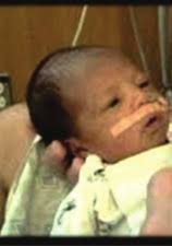 BUNDLING UP BEST PRACTICES: IMPROVING OUTCOMES FOR VERY LOW BIRTH WEIGHT  INFANTS Background Outcomes Conclusions References Desc