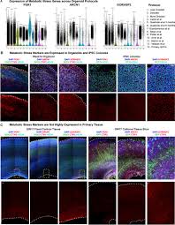 Glycolysis and ER stress across culture systems a, Markers of metabolic...  | Download Scientific Diagram