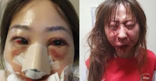 Shangyu has plenty of cafes. Doctor Jailed 3 5 Years For Smashing Ex Gf Who Refuse Him Sex