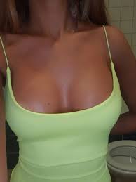 Foto dopo mastoplastica 200cc e 300 cc - Ingrandimento del seno - aumento -  Forum | Estheticon.it