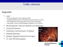 Kurzfassung auslöser von divertikulitis ist ein ungesunder lebensstil. Gastrointestinaltrakt Ppt Herunterladen