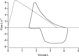 Image result for Lung Function Questionnaire
