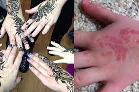 Folge deiner leidenschaft bei ebay! Fda Warns Against Harmful Ingredient In Black Henna Tattoo Ink Mpr