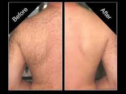 So, what's the best way to remove back hair? Back Hair Removal Or Remove Back Hair Amazing Method Youtube