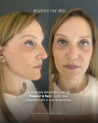 Dra. Franciele de Freitas