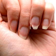 The rate of growth of human fingernails varies, depending on the person, the nail in question, and the time of year. Learn How To Grow Long Gorgeous Nails Naturally
