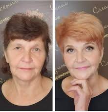 Feeling amazing thanks to everyone for all your support and recipes!!!! (  last pic was removed)