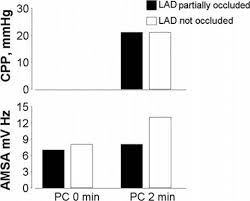 We would like to show you a description here but the site won't allow us. Amplitude Spectrum Area As A Predictor Of Successful Defibrillation Springerlink