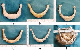 Image result for Hyoid Bone