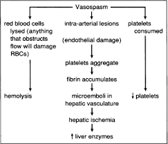 10 what is the medical advice for proteinuria patients? Severe Preeclampsia Implications For Critical Care Obstetric Nursing Journal Of Obstetric Gynecologic Neonatal Nursing