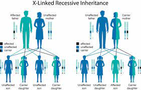 Duchenne Muscular Dystrophy Causes Symptoms Diagnosis Treatment Life Expectancy