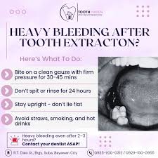 Image result for Post-Tooth Extraction Bleeding