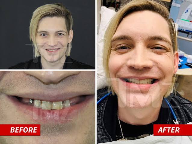 The Calling Singer Alex Band Gets New Teeth and It's Gnarly
