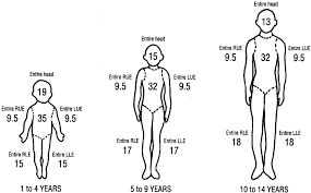 Note that escharotomy lines on the thumb and little finger, as an international standard, should be always performed on the radial side and not on the ulnar side. Burn Wound Infections Clinical Microbiology Reviews