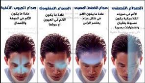 صداع خلف الراس من الجهه اليسرى اسباب صداع الراس الايسر كلام حب