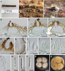 4k porn, 8k porn, hd porn, ultra hd, 1080 porn, romantic, trans, outdoor, tattoos, tinder you can find more videos like euro stud's hairy hole below in the related videos section. Taxonomy And Phylogeny Of Hyaline Spored Coelomycetes Springerlink