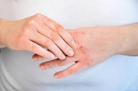 7 Cosas Que Las Manos Dicen Sobre Nuestra Salud