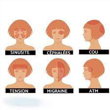Check spelling or type a new query. Quels Sont Les Differents Maux De Tete Images Symptomes Et Traitement