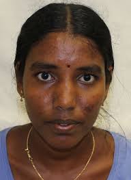 Authorities identify Alabama A&M student found in Hazel Green pond