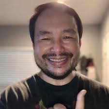 🚴‍♂️ On June 1st, I experienced a life-altering bicycle accident that  resulted in a skull fracture, facial fracture, and a left clavicle  fracture. I was found unconscious and required intubation before being