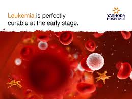 Maybe you would like to learn more about one of these? Leukemia Is Perfectly Curable At The Early Stage