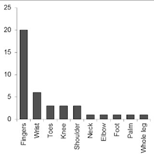 We did not find results for: Frequency Of Symptoms Chosen By Patients When Completing The Webmd Download Scientific Diagram