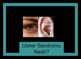 Usher Sendromu Nedir Egitim Rehber Hayat