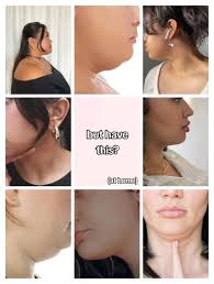 Double Chin Insecurity