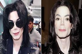 Man Spends N11M On Surgery To Look Like Michael Jackson