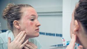Tk is listed in the world's largest and most authoritative dictionary database of abbreviations and acronyms. Diagnose Per Foto Tk Bietet Digitalen Haut Check An Stern De