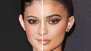 Reality television series keeping up with the kardashians. Kylie Jenner Before And After Plastic Surgery Youtube