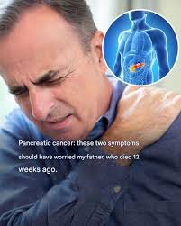 Pancreatic Cancer: 10 Symptoms That Can Help You Spot It (Don't Ignore  Them). article in comments