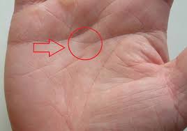 Palm (inner, concave part of hand). Selvdiagnose Pa Hovedlinjene I Handflaten Gjetter Pa Den Gale Linjen