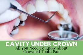 When cemented in place, it restores the size, shape, and functions of the tooth. Cavity Under Crown All You Need To Know About Crowned Tooth Pain