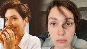 Üçüncü kez anne olmaya hazırlanan bergüzar korel, eşi halit ergenç ve çocuklarıyla birlikte tatilde objektiflere takıldı. Berguzar Korel Burnum Eski Haline Donecek Mi Magazin Haberleri Milliyet