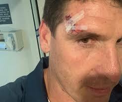 NPL: Charlestown striker Kane Goodchild keen to hit back against Valentine 